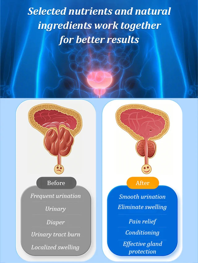 Saw Palmetto Prostate Health Supplement