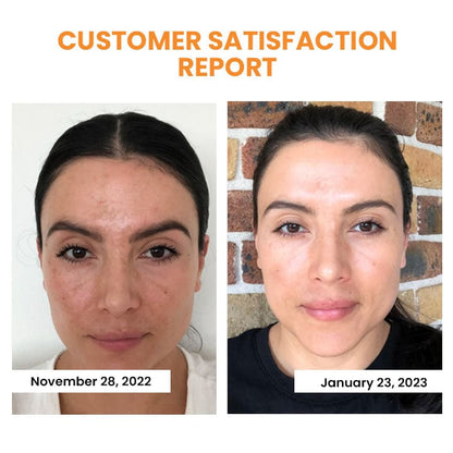 🔥Last Day Promotion 49% OFF -- LOVILDSTM Korean Dermalayr Technology Soluble Collagen Film