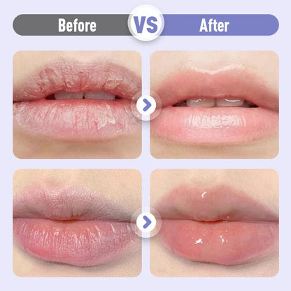 ❣️Buy 1 Get 1 Free❣️Plumping & Anti-Wrinkle Hydrating Lip Serum