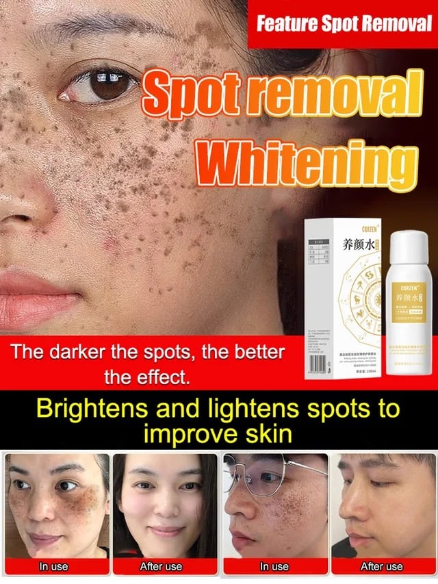 [All kinds of spots can be removed with one spray]Blemish removal, whitening and beauty water
