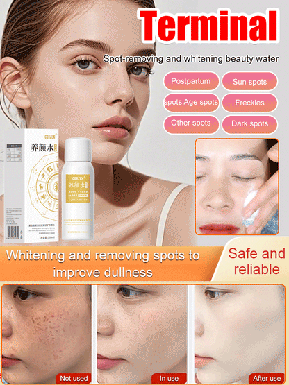 [All kinds of spots can be removed with one spray]Blemish removal, whitening and beauty water