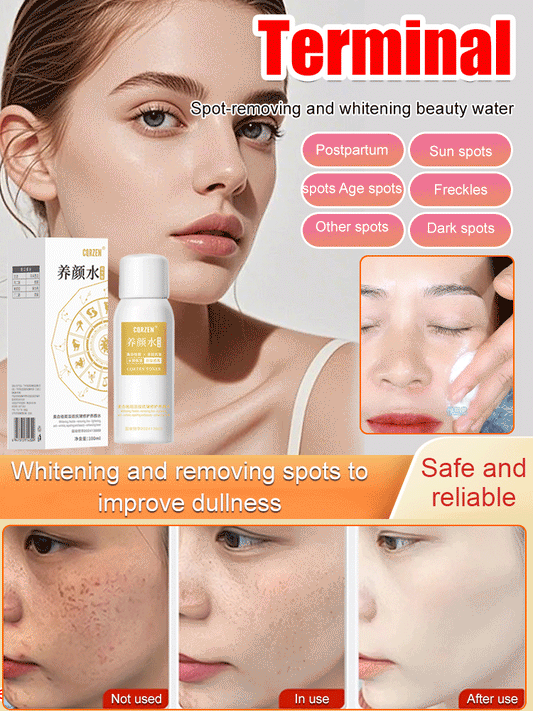[All kinds of spots can be removed with one spray]Blemish removal, whitening and beauty water